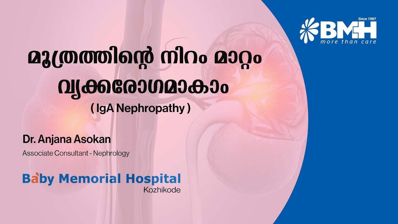മൂത്രത്തിലെ നിറവ്യത്യാസം അവഗണിക്കരുത്; ഐജിഎ നെഫ്രോപതിയാകാം