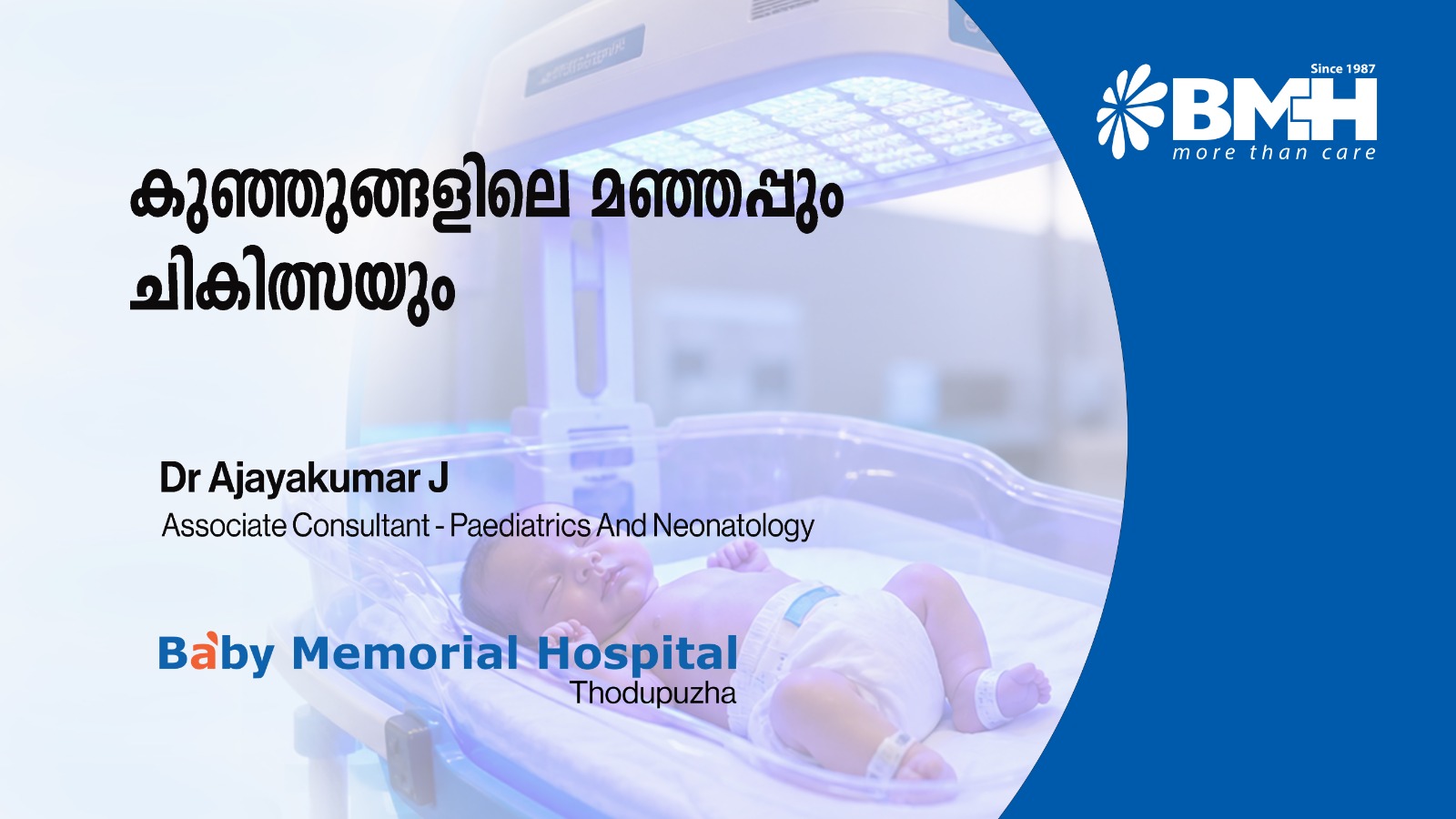 നവജാത ശിശുക്കളിലെ മഞ്ഞപ്പിത്തം: കാരണങ്ങളും ചികിത്സാരീതികളും