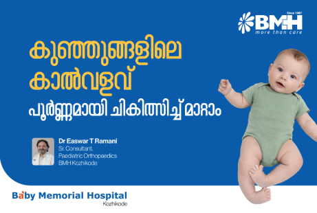 Dr Easwar T Ramani explains Clubfoot- CTEV-causes and treatment in children