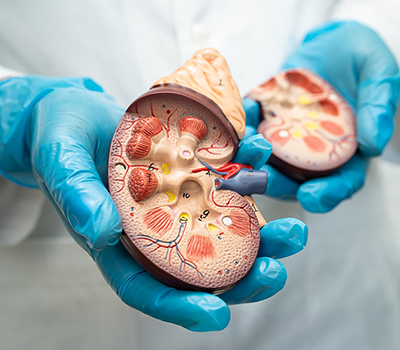 Kidney Transplant: Eligibility, Procedure Steps & Life After Transplantation