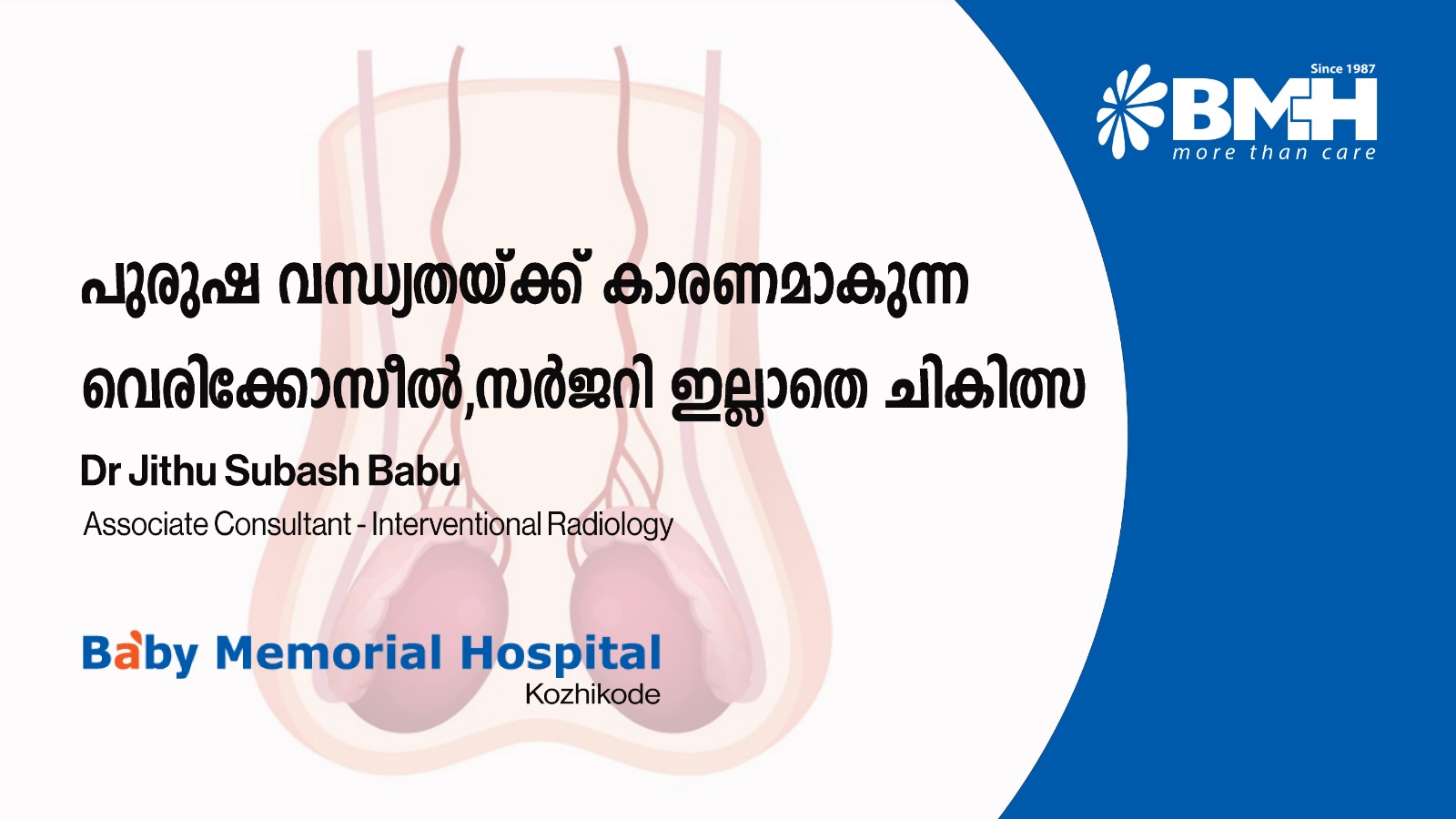 പുരുഷന്മാരിലെ വന്ധ്യതയും വേരിക്കോസീലും: സർജറിയില്ലാത്ത എംബൊലൈസേഷൻ ചികിത്സാ