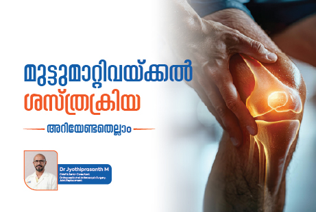 Knee Replacement Guide