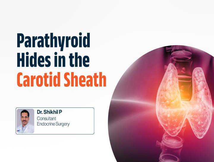When the Parathyroid Hides in the Carotid Sheath