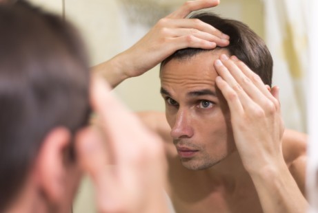 Hair Loss in Men and Women: Causes and Best Treatment Options  