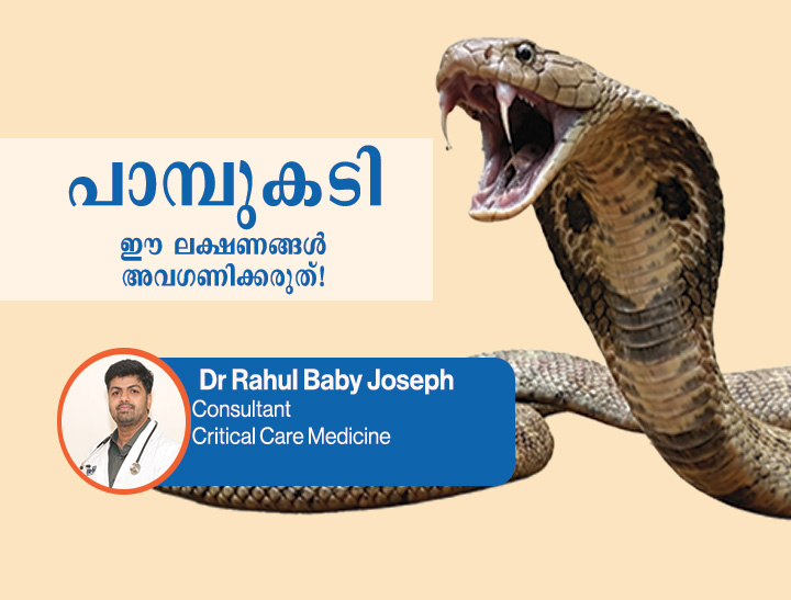 Critical Care specialist Dr Rahul Baby  explains Snake Bite First Aid & Treatment Guide
