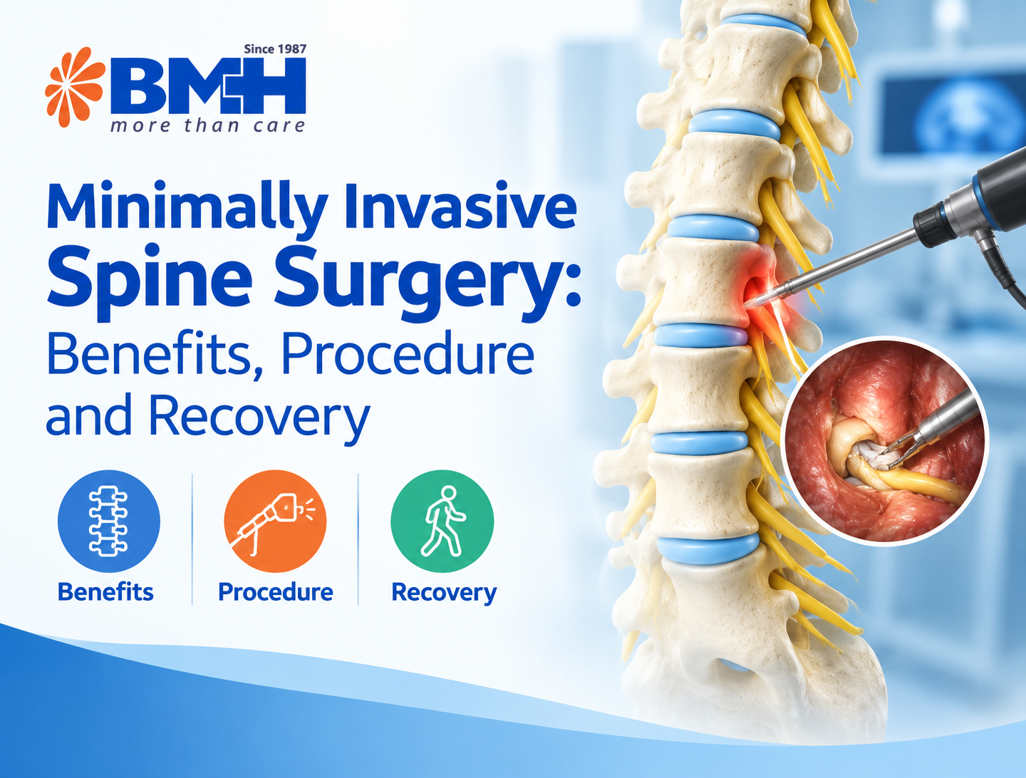 Minimally Invasive Spine Surgery: Benefits, Procedure and Recovery