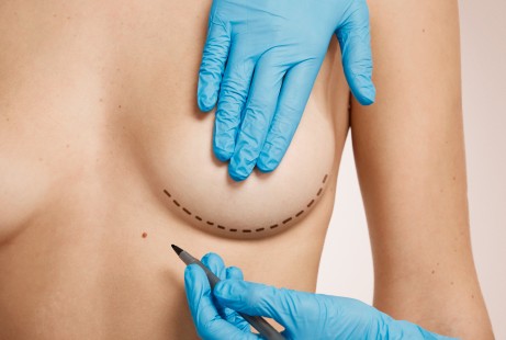   Breast Reconstruction After Mastectomy: Options and Recovery 