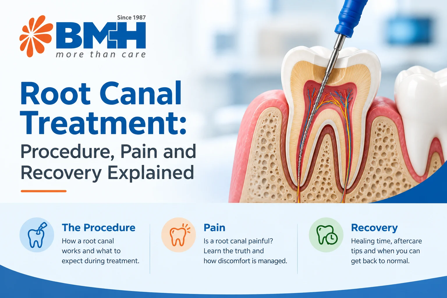 Root Canal Treatment: Procedure, Pain and Recovery Explained