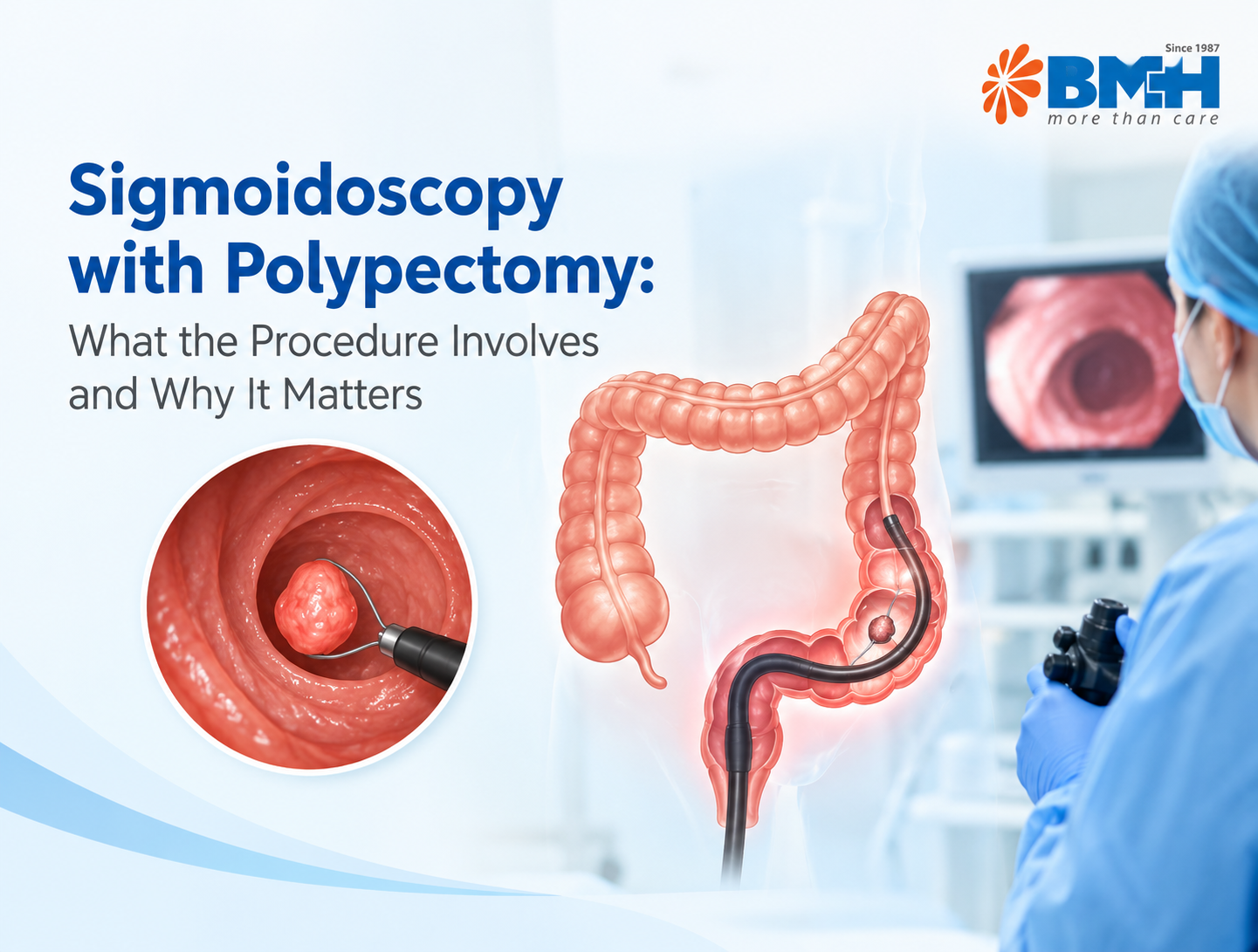 Sigmoidoscopy with Polypectomy: What the Procedure Involves and Why It Matters