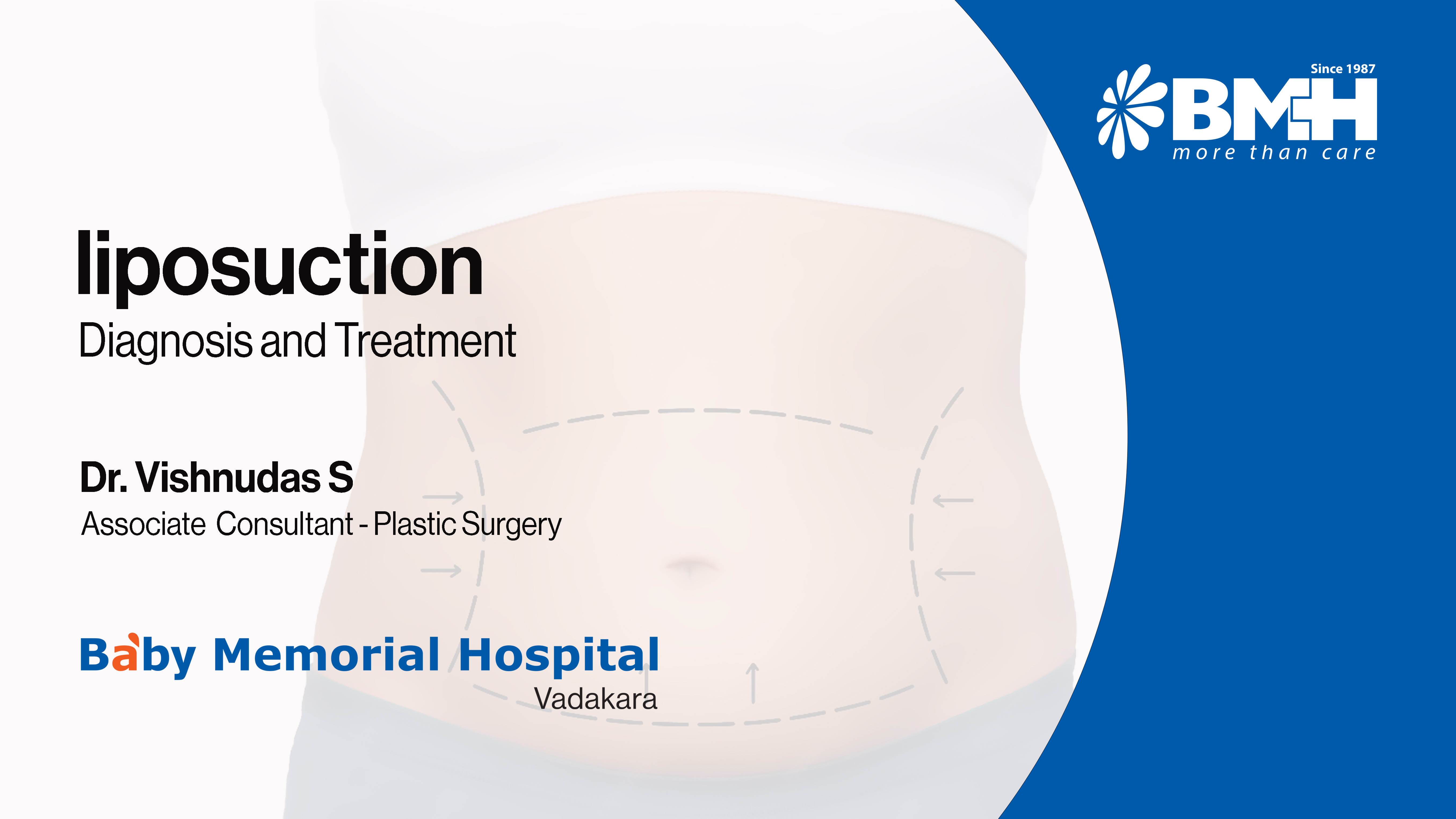 ശരീരത്തിലെ അമിത കൊഴുപ്പ് നീക്കം ചെയ്യാൻ ലൈപോസെക്ഷൻ