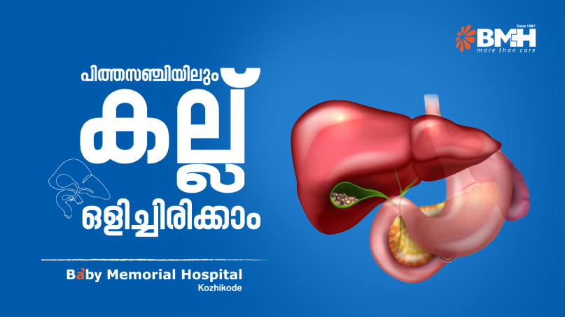 പിത്തസഞ്ചിയിലെ കല്ല്, ചികിത്സ വൈകിപ്പിക്കരുത്‌