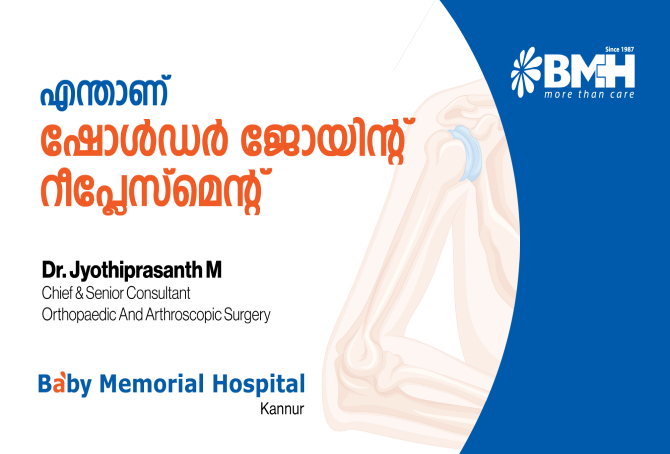 തോളിലെ തേയ്മാനവും പരിഹാരങ്ങളും: ഷോൾഡർ ജോയിന്റ് റീപ്ലേസ്മെന്റ് അറിയേണ്ടതെല്ലാം
